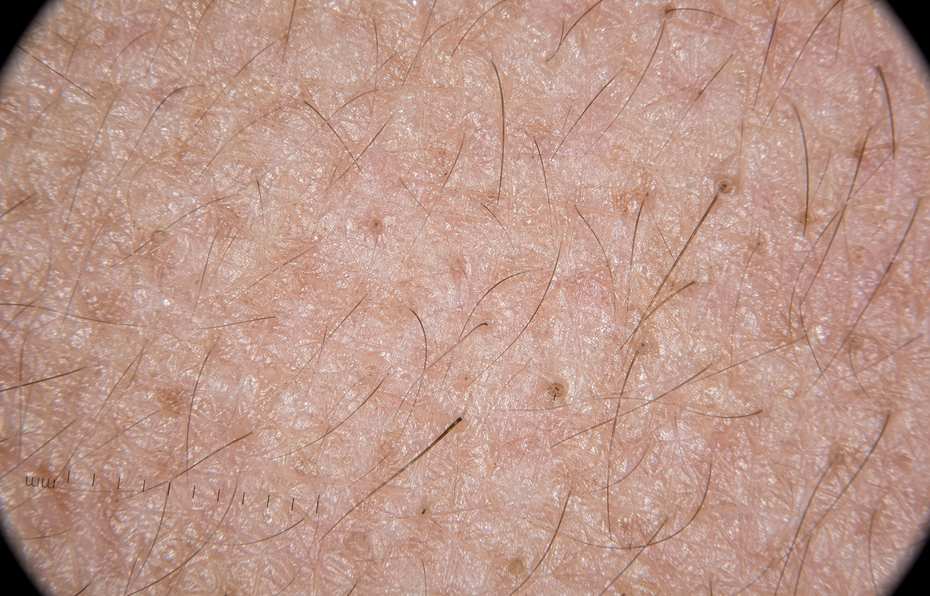 dermatologia